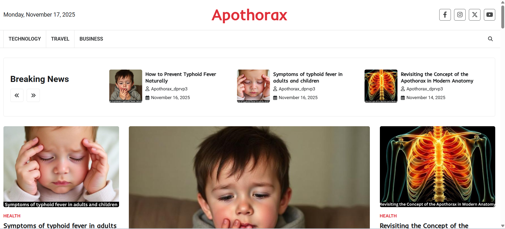 Understanding “Apothorax”: Definition, Location & Key Organs